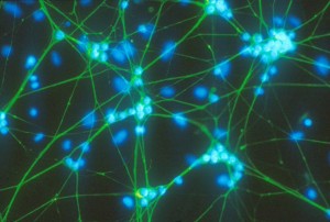 Les connexions neuronals determinen l’estructura del nostre cervell