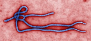 Virus de forma filamentosa o filovirus causant de l'ebola